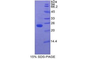 SDS-PAGE (SDS) image for Insulin-Like Growth Factor Binding Protein 6 (IGFBP6) (AA 46-238) protein (His tag) (ABIN1880059) (IGFBP6 Protein (AA 46-238) (His tag))