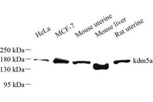 Western blot analysis of kdm5a (ABIN7074532) at dilution of 1: 500 (KDM5A antibody)