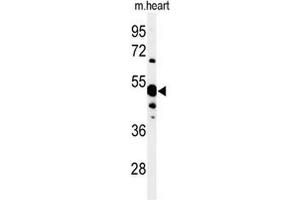 Western blot analysis of 5NT1A Antibody (N-term) in mouse heart tissue lysates (35 µg/lane). (NT5C1A antibody  (N-Term))