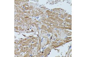 Immunohistochemistry of paraffin-embedded mouse heart using FLII antibody (ABIN7267217) at dilution of 1:100 (40x lens).