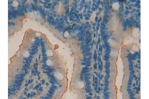 DAB staining on IHC-P; Samples: Mouse Intestine Tissue (ACP5 antibody  (AA 28-286))