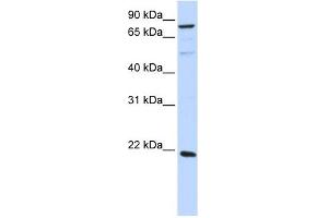 ARL11 antibody used at 1 ug/ml to detect target protein. (ARL11 antibody  (Middle Region))