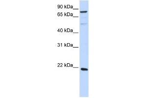 ARL11 antibody used at 1 ug/ml to detect target protein.