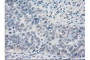 Immunohistochemical staining of paraffin-embedded Ovary tissue using anti-PORmouse monoclonal antibody. (POR antibody)