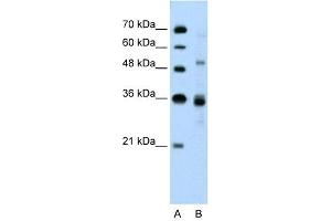 WB Suggested Anti-TNRC4 Antibody Titration: 0. (CELF3 antibody  (N-Term))