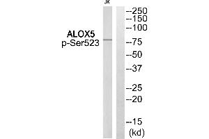 Western blot analysis of extracts from Jurkat cells, using ALOX5 (Phospho-Ser523) Antibody. (ALOX5 antibody  (pSer523))