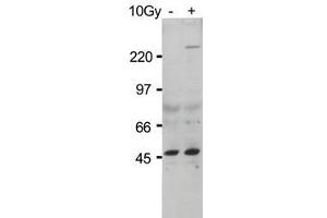 Anti-ATM Monoclonal Antibody - Western Blot. (ATM antibody  (AA 1974-1988) (Biotin))