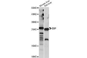 Western blot analysis of extracts of various cell lines, using EBP antibody. (EBP antibody)
