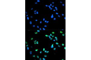 Immunofluorescence analysis of HeLa cell using IRF5 antibody. (IRF5 antibody)