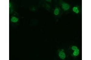 Anti-UCK1 mouse monoclonal antibody (ABIN2453771) immunofluorescent staining of COS7 cells transiently transfected by pCMV6-ENTRY UCK1 (RC220876). (UCK1 antibody)