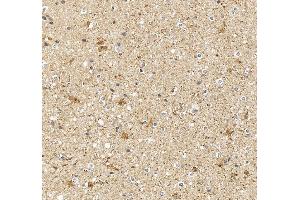 anti-Dimethylarginine Dimethylaminohydrolase 1 (DDAH1) (AA 195-226), (C-Term) antibody