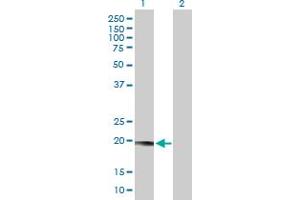 Western Blot analysis of LYZL1 expression in transfected 293T cell line by LYZL1 MaxPab polyclonal antibody. (Lysozyme-Like 1 antibody  (AA 1-194))