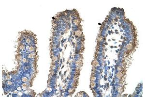 RHOBTB1 antibody was used for immunohistochemistry at a concentration of 4-8 ug/ml to stain Epithelial cells of intestinal villus (arrows) in Human Intestine. (RHOBTB1 antibody  (Middle Region))