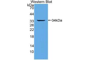 Western blot analysis of the recombinant protein. (TNFRSF11A antibody  (AA 330-615))