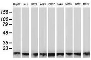 Image no. 1 for anti-ATPase, H+ Transporting, Lysosomal 14kDa, V1 Subunit F (ATP6V1F) antibody (ABIN1496778) (ATP6V1F antibody)