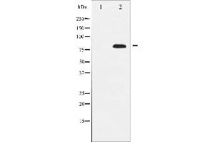 Western blot analysis of Rel expression in MDA-MB-435 whole cell lysates,The lane on the left is treated with the antigen-specific peptide. (c-Rel antibody  (Internal Region))
