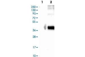 Western Blot analysis of Lane 1: negative control (vector only transfected HEK293T cell lysate) and Lane 2: over-expression lysate (co-expressed with a C-terminal myc-DDK tag in mammalian HEK293T cells) with GPR77 polyclonal antibody . (GPR77 antibody)