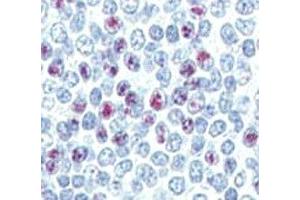 IHC analysis of FFPE human spleen tissue stained with LIN28B antibody