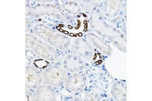 Immunohistochemistry of paraffin-embedded rat kidney using EVA Rabbit pAb  at dilution of 1:100 (40x lens). (TMEM166 antibody)