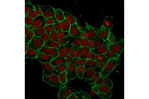 Immunofluorescence (IF) image for anti-Epithelial Cell Adhesion Molecule (EPCAM) (AA 77-202), (Extracellular Domain) antibody (ABIN6939977)