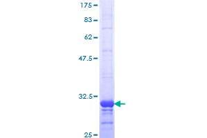 Image no. 1 for Chemokine (C-C Motif) Receptor 2 (CCR2) (AA 1-42) protein (GST tag) (ABIN1348495) (CCR2 Protein (AA 1-42) (GST tag))