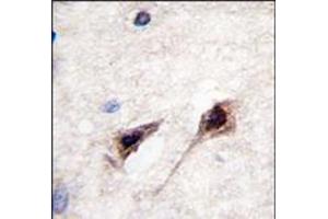 Image no. 1 for anti-Myocyte Enhancer Factor 2C (MEF2C) (Ser387) antibody (ABIN358801) (MEF2C antibody  (Ser387))