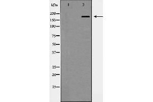 Western blot analysis of Integrin β4 expression in HepG2 cells. (Integrin beta 4 antibody  (C-Term))