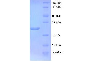 SDS-PAGE (SDS) image for TCYA (AA 20-268) protein (His tag) (ABIN5714080) (TCYA (AA 20-268) protein (His tag))