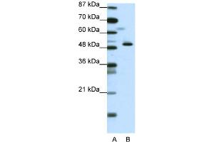 WB Suggested Anti-ZNF259 Antibody Titration:  0. (ZNF259 antibody  (N-Term))