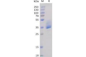Human BAFF-R Protein, mFc Tag on SDS-PAGE under reducing condition. (TNFRSF13C Protein (mFc Tag))