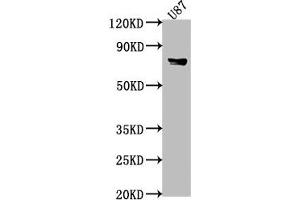 FEM1B Antikörper  (AA 400-627)
