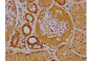 IHC image of ABIN7156191 diluted at 1:100 and staining in paraffin-embedded human kidney tissue performed on a Leica BondTM system. (PTK7 antibody  (AA 772-1070))