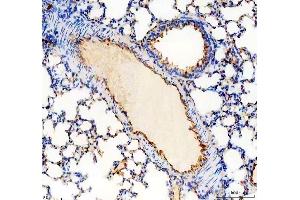 IHC analysis of CD31/Pecam1 using anti-CD31/Pecam1 antibody (ABIN7601662).