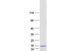 Validation with Western Blot (s100a4 Protein (Transcript Variant 2) (Myc-DYKDDDDK Tag))