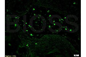 Immunofluorescence (IF) image for anti-CD8 (CD8) (AA 51-150) antibody (ABIN671391)