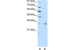 WB Suggested Anti-PITX3 Antibody Titration:  0. (PITX3 antibody  (N-Term))