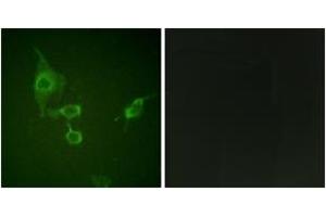 Immunofluorescence analysis of HepG2 cells, using HCK (Ab-410) Antibody. (HCK antibody  (AA 381-430))