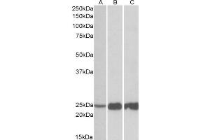ABIN1590039 (0. (TNNI2 antibody  (N-Term))