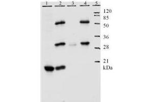 Western Blotting (WB) image for anti-Human Papilloma Virus 11 E7 (HPV-11 E7) (AA 1-35), (N-Term) antibody (ABIN781776) (Human Papilloma Virus 11 E7 (HPV-11 E7) (AA 1-35), (N-Term) antibody)