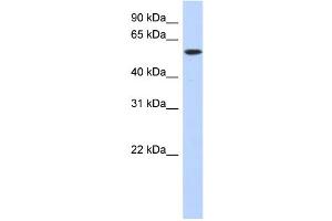 WB Suggested Anti-DNTT Antibody Titration: 0. (TdT antibody  (Middle Region))