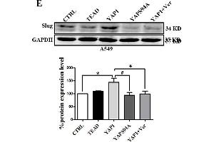 Slug is regulated by the co-transcriptional complex YAP1/TEAD in the EMT program of A549 cells. (GAPDH antibody)