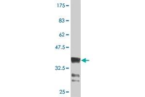 Western Blot detection against Immunogen (36. (HOXB9 antibody  (AA 65-163))