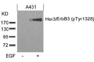 Image no. 2 for anti-Receptor Tyrosine-Protein Kinase ErbB-3 (ERBB3) (pTyr1328) antibody (ABIN319274) (ERBB3 antibody  (pTyr1328))
