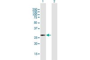 Western Blot analysis of ATF2 expression in transfected 293T cell line by ATF2 MaxPab polyclonal antibody. (ATF2 antibody  (AA 1-209))