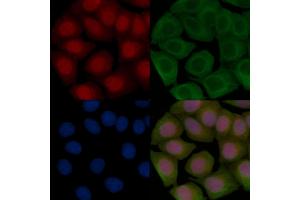 ABIN7093235 and ABIN7097247 staining Hela cells(45 min of heat-shock treatment) by IF/ICC. (FOXO3 antibody  (acLys290))