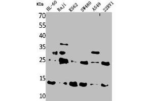 Western Blot analysis of HL-60 Raji K562 SW480 A549 22RV-1 cells using TRP14 Polyclonal Antibody (TXNDC17 antibody  (Internal Region))