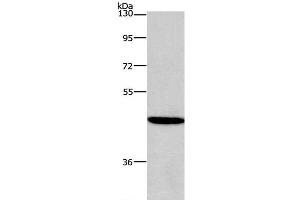 Western Blot analysis of 293T cell using HDAC8 Polyclonal Antibody at dilution of 1:950 (HDAC8 antibody)