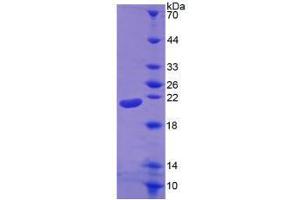 Image no. 2 for Interleukin 1, beta (IL1B) (AA 117-269) (Active) protein (His tag) (ABIN5665827) (IL-1 beta Protein (AA 117-269) (His tag))