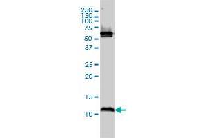 ATPIF1 monoclonal antibody (M01), clone 3E2 Western Blot analysis of ATPIF1 expression in MCF-7 . (ATPase Inhibitory Factor 1 antibody  (AA 1-106))