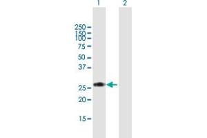 Western Blot analysis of RPIA expression in transfected 293T cell line by RPIA MaxPab polyclonal antibody. (Ribose 5-Phosphate Isomerase A (RPIA) (AA 1-237) antibody)